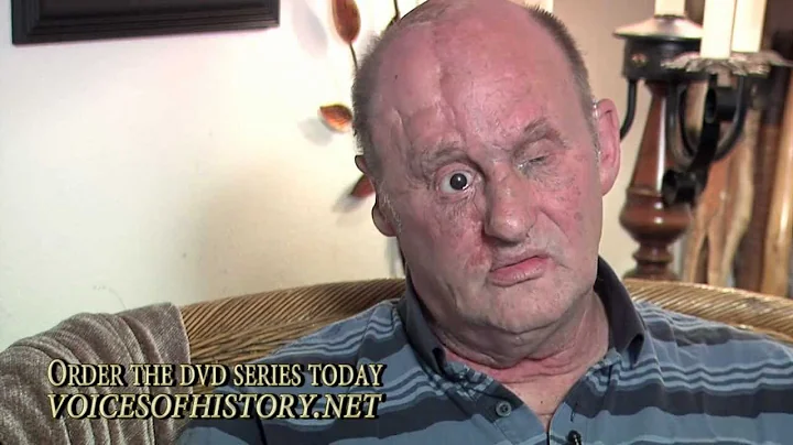 Bill Wedekind, USMC, Vietnam War, Wounded Warrior,...