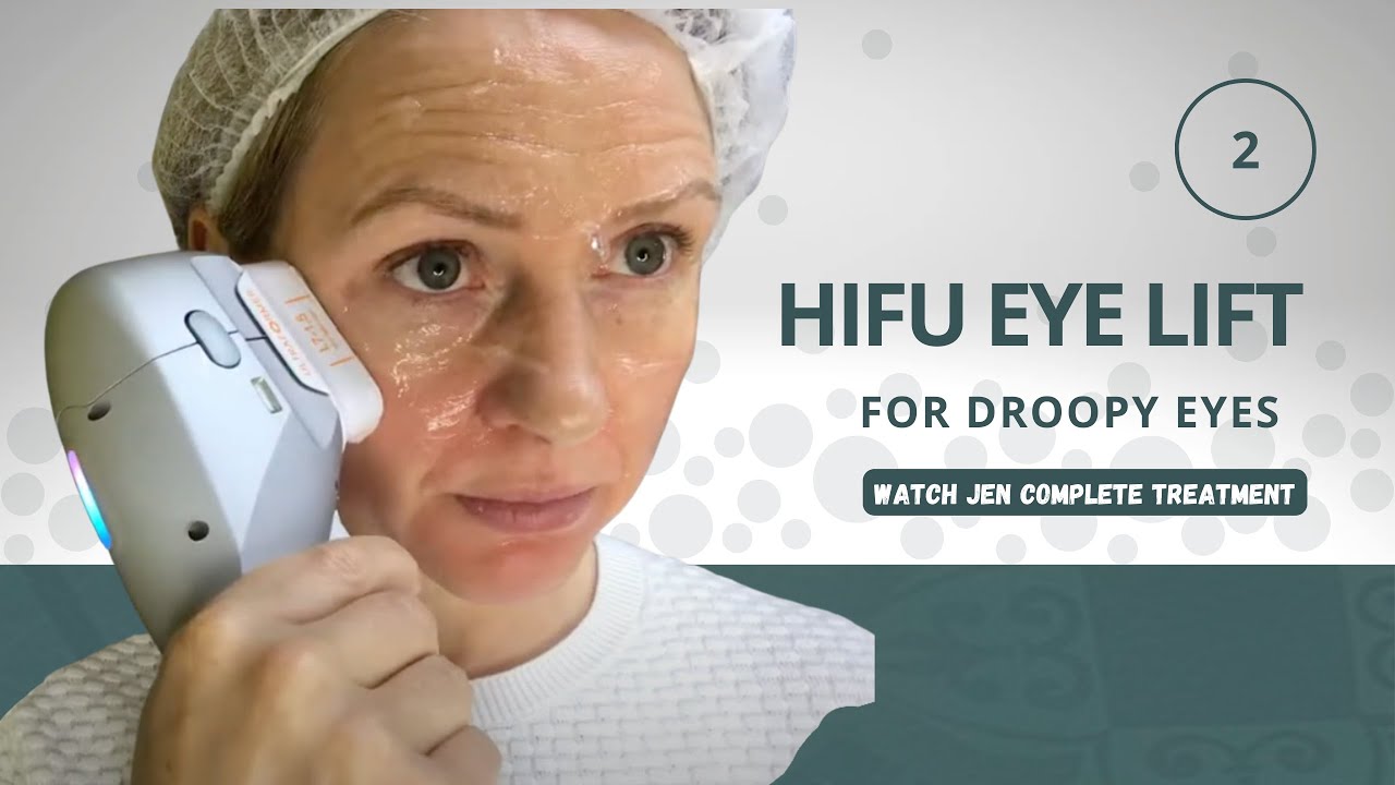 Unlocking Youthful Eyes HIFU Eye Lift Revealed YouTube Unlocking Youthful Eyes HIFU Eye Lift Revealed YouTube