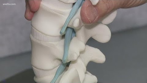 New procedure gives instant relief for spinal stenosis