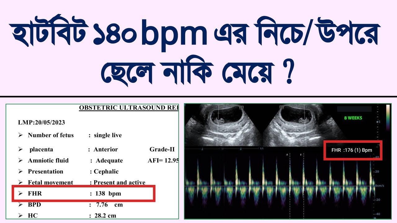 হার্টবিট দেখে ছেলে নাকি মেয়ে? আসল সত্য জানুন ! Ultrasound report boy or girl Detected