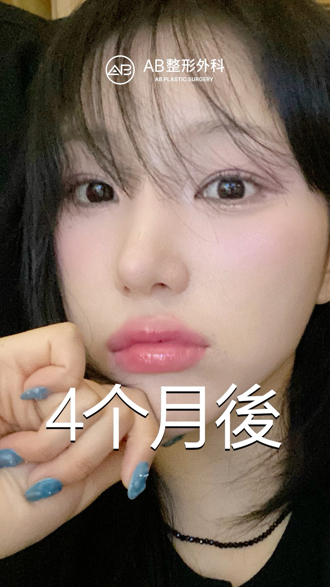 只改眼鼻，整個氣質變了！ #shorts