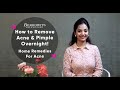 How to Remove Pimples & Acne Overnight | Acne Treatment