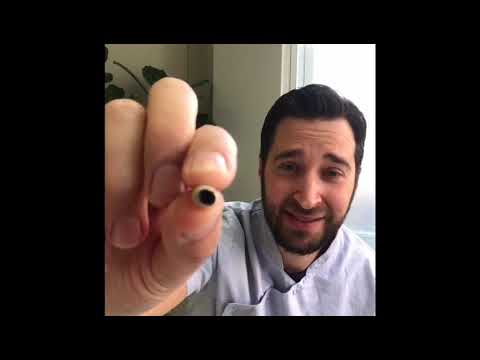 How to repair a broken tooth or recement a crown at home