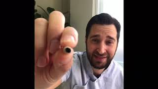 How To Repair A Broken Tooth Or Recement A Crown At Home