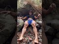 Muscle pull pull