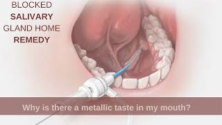 Blocked salivary gland home remedy |Why is there a metallic taste in my mouth?