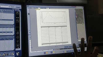 CSF flow study MRI POST PROSESING