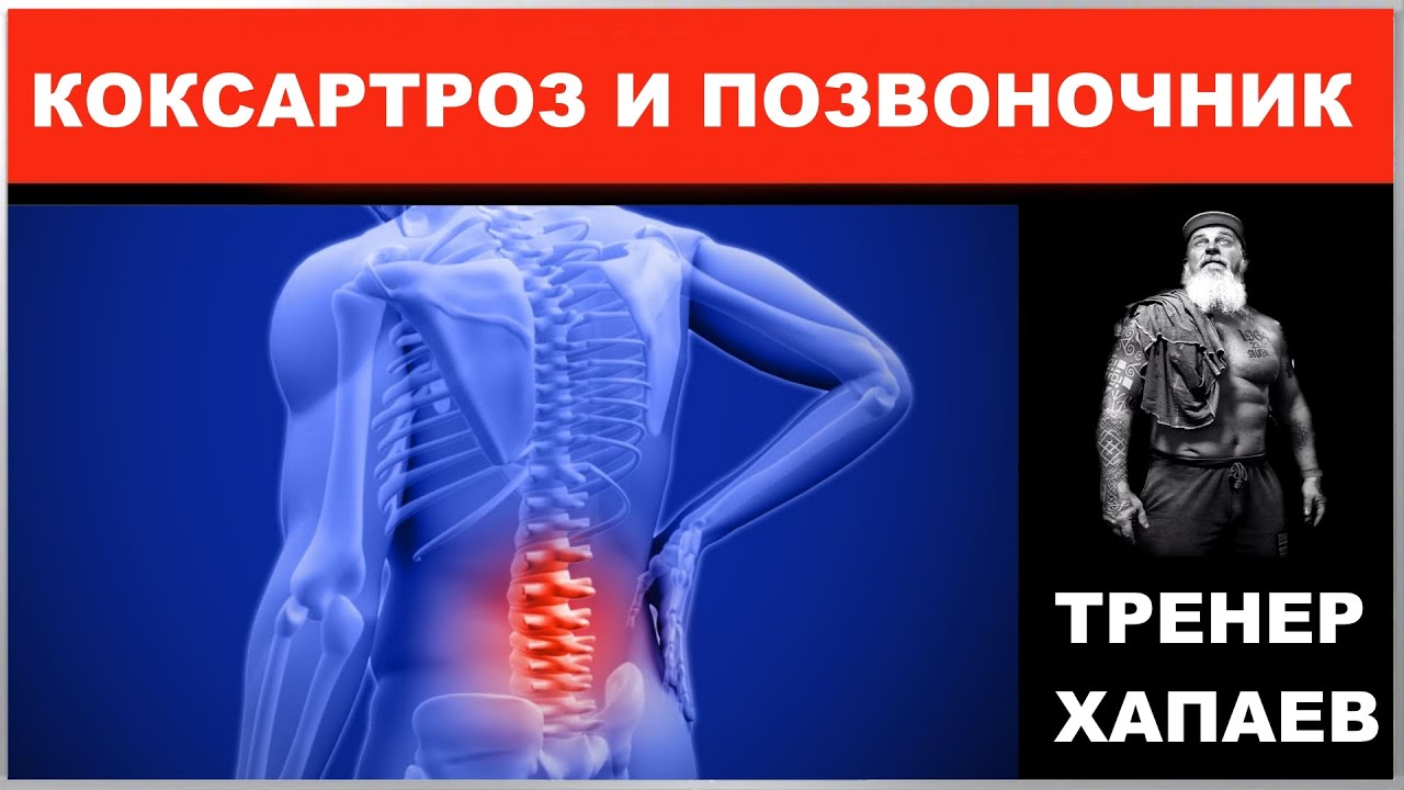 книги о спине и позвоночнике. коксартроз спины. коксартроз спины. остеоартроз коксартроз тазобедренного сустава. микрос тазобедренного сустава.