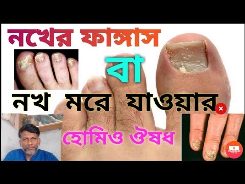 ভিডিও: রাজমিস্ত্রির নখ কি ইট বা মর্টারে যায়?