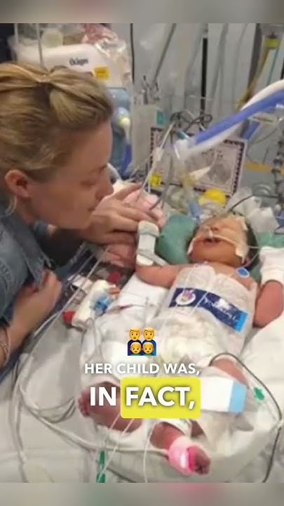 this-dead-baby-born-at-five-months-and-eighth-minutes-later-foryou