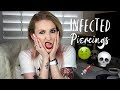 IS MY PIERCING INFECTED? | Signs Of An Infected Piercing