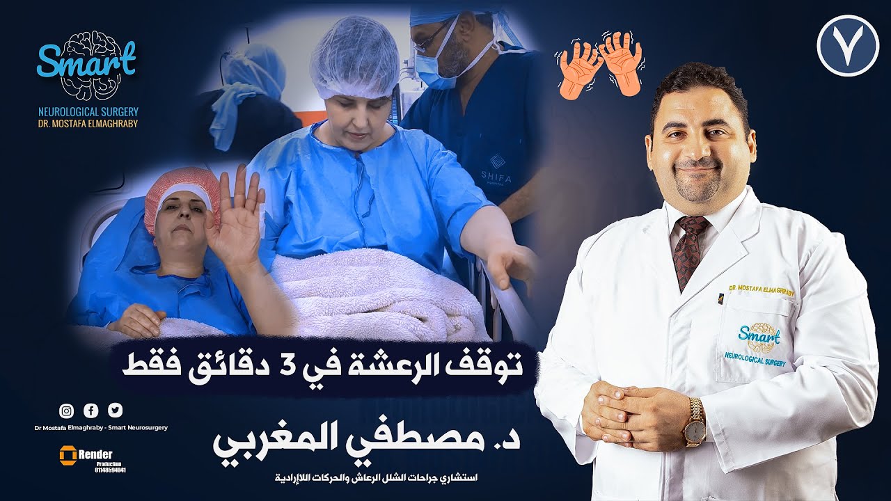 عملية الشلل الرعاش  في اليد اليسري  توقف الرعشة في ٣ دقائق فقط
