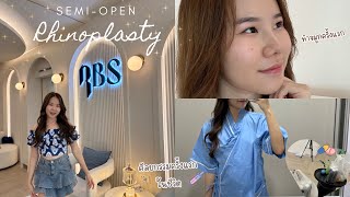 เสริมจมูกครั้งแรก🩺👩‍⚕️ semi-open ที่ rbsclinic จะปังมั้ยยย?💉| thelittlecream