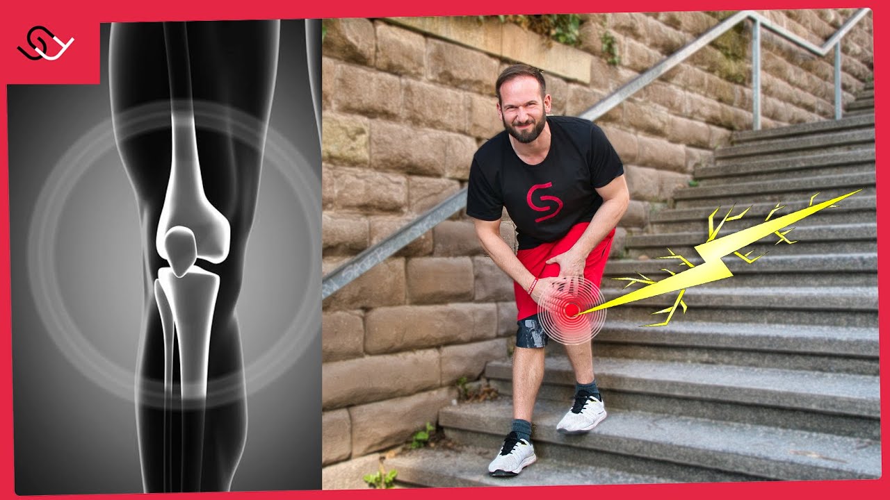 Knieschmerzen - Mach diese Übung! (kennt fast keiner)