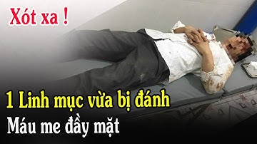 🔴Tin Mới! Xót Xa 1 Linh Mục Trẻ Vừa Bị Đánh Thương Tâm Lúc Này - Xin Cầu Nguyện l Đinh Thập Tự