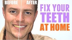 How To Get Beautiful Teeth Without Going to a Dentist! 