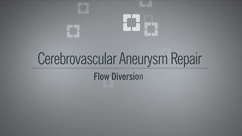 Aneurysm Flow Diversion