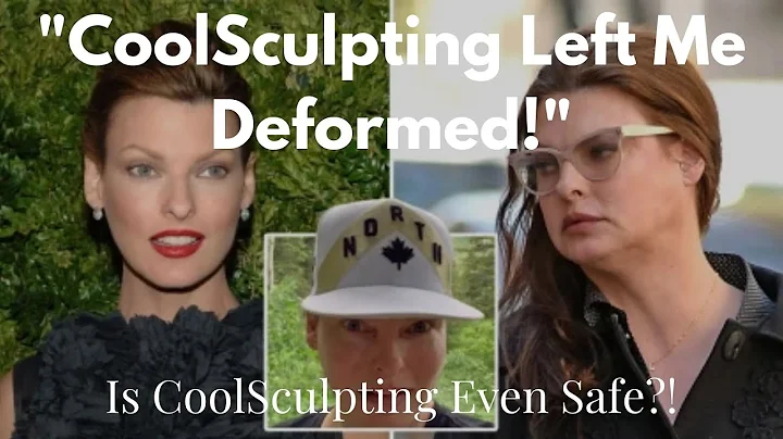 CoolSculpting: Güvenli Zayıflama Yolu!