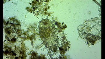 Microarthropod and nematode 100x @RovingMicroscope