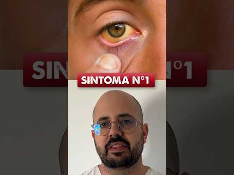 ¡SÍNTOMAS DE HÍGADO