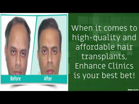 Hair transplantation in Delhi Mumbai Kolkata hair transplant cost in  Mumbai Enhance Clinics  YouTube