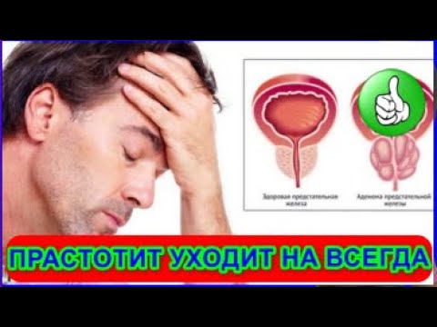 Можно вылечить хронический простатита навсегда. Аденома простаты евдокименко. можно ли вылечить хронический простатита навсегда. как лечить простату огурцом.