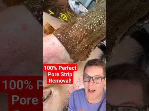 Perfect Pore Strip Removal Shorts