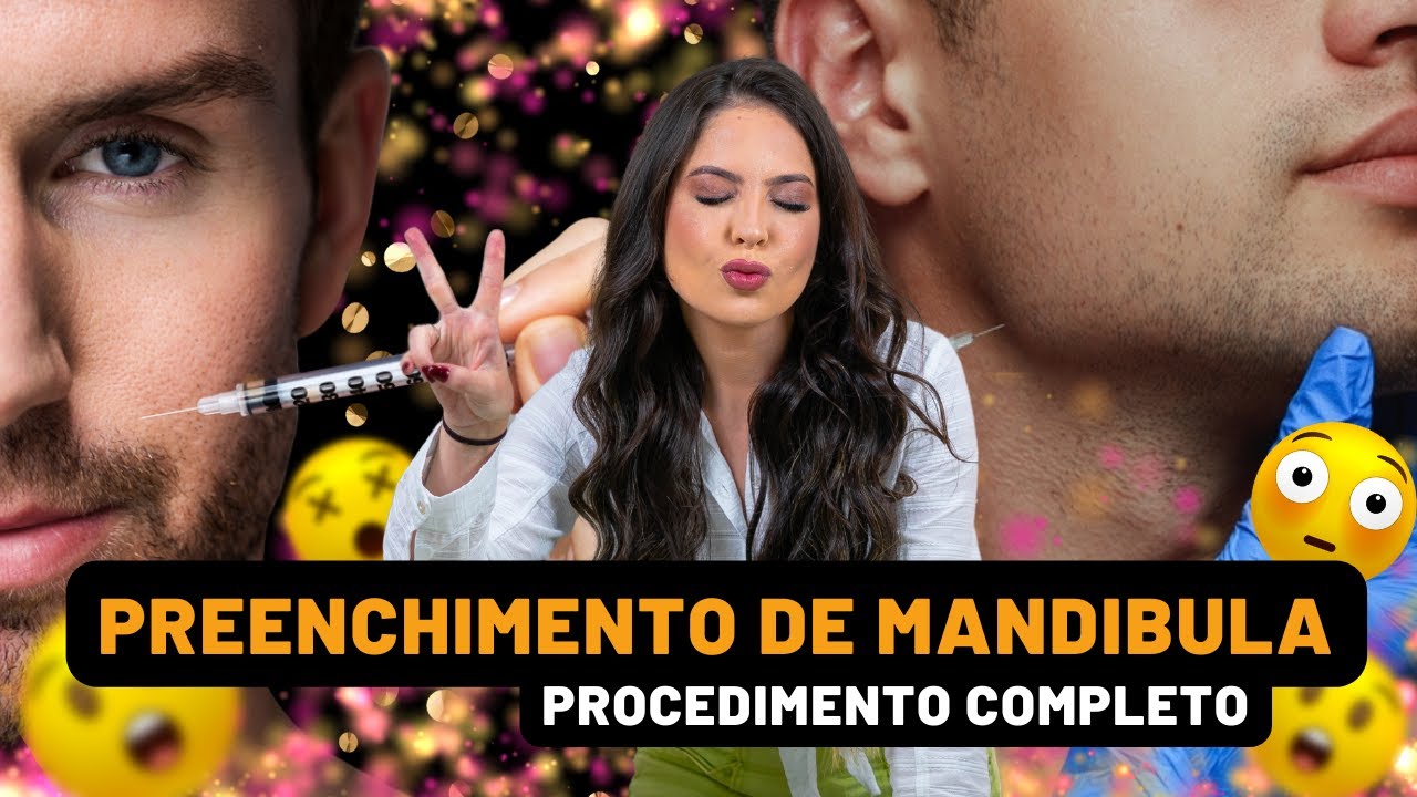 Preenchimento de Mandíbula - Dra. Camila Calazans