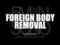 Removing a foreign body with ultrasound