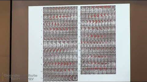 The Modular Brain