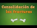 Proceso de consolidación de los huesos o consolidación de las fracturas