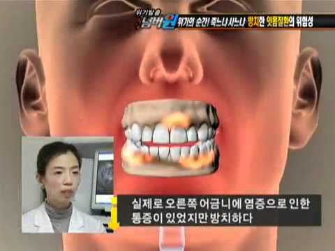 위기탈출 넘버원 Crisis Escape No1 20101108 006