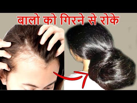 Try This Homemade Oil and 🙅♀️ STOP HAIR FALL FAST Naturally - Priya Malik - 동영상