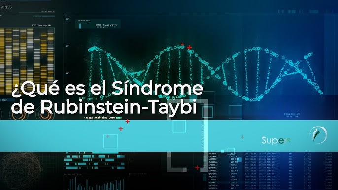 Síndrome de Rubinstein-Taybi: Causas, características y