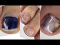 Педикюр на себе / Ужасно запущенные ногти / Как сделать блик на весь ноготь
