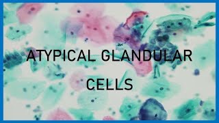 Atypical Glandular Cells
