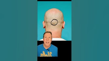 The external occipital protuberance #dreldersanatomychannel