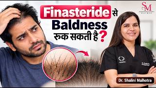 Baldness बढ़ रही है? Finasteride Treatment शुरू करने से पहले ये जानें | Dr. Shalini Malhotra
