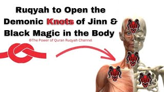 Very Powerful Ruqyah to Open the Demonic Knots of Jinn & Blackmagic in the Body & Disease caused