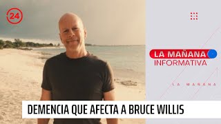 Experta por demencia que afecta a Bruce Willis: 'Parte 10 años antes que el Alzheimer'