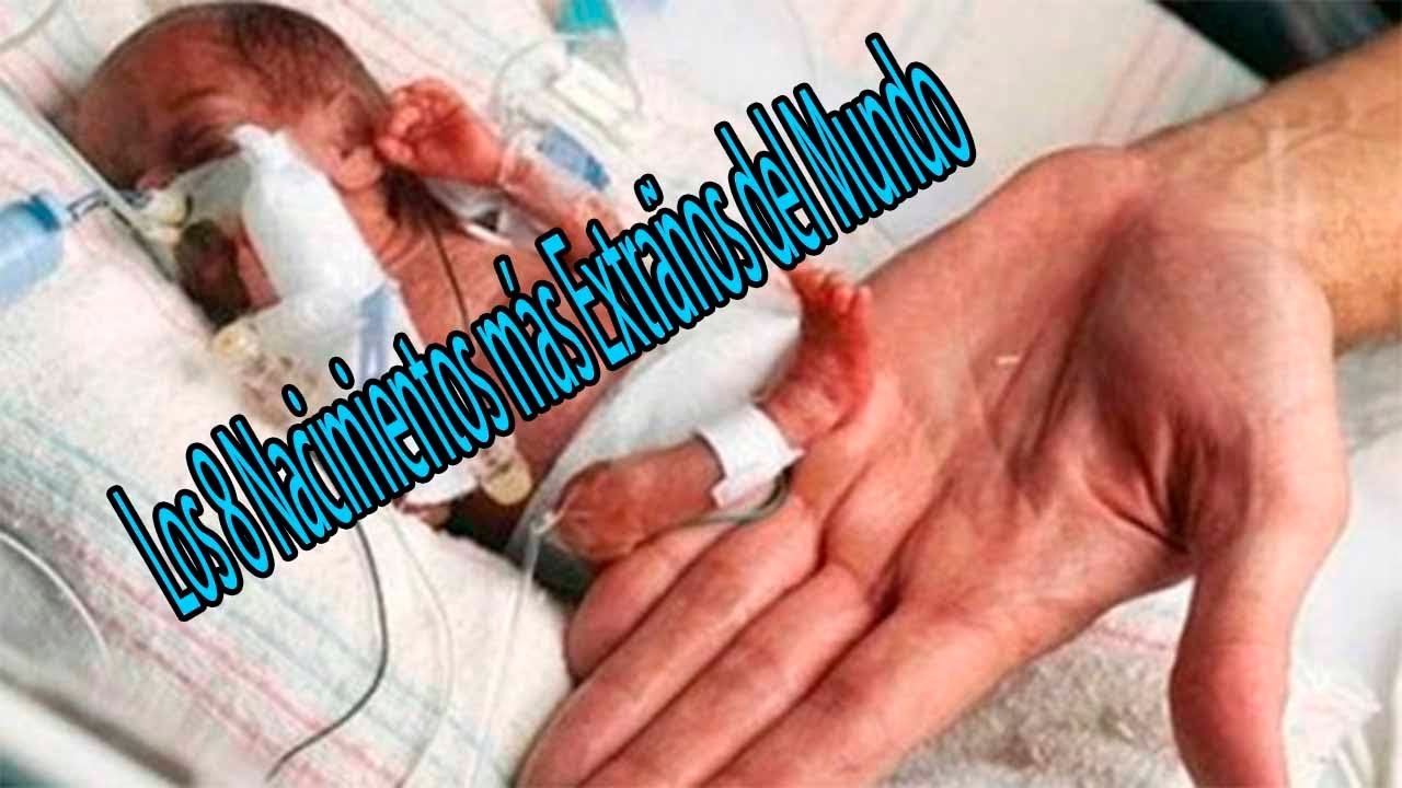 Los 8 Nacimientos más Extraños del Mundo • Me Copiate - YouTube