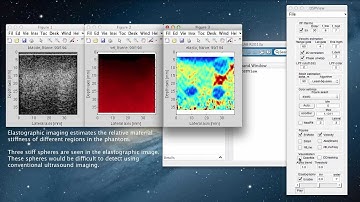 DSPView - Ultrasound and Image Processing in MATLAB