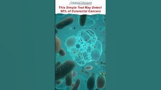 This Simple Test May Detect 90% of Colorectal Cancers