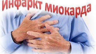 Видео ТЕСТ: СКЛОННЫ ЛИ ВЫ К ИНФАРКТУ!? (автор: Kamrad-TV)