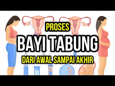 Video: 3 Cara untuk Menciptakan Pengalaman Persenyawaan Vitro yang Positif