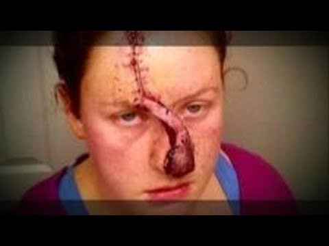 Dr.’s Investigate: Dangerous DIY Treatment for Autism; Bizarre way to get Buff!; Food that cuts c…
