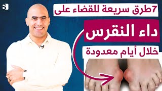 علاج النقرس بدون ادوية خلال ايام | افضل سبعة طرق للتخلص من التهاب المفاصل واليوريك