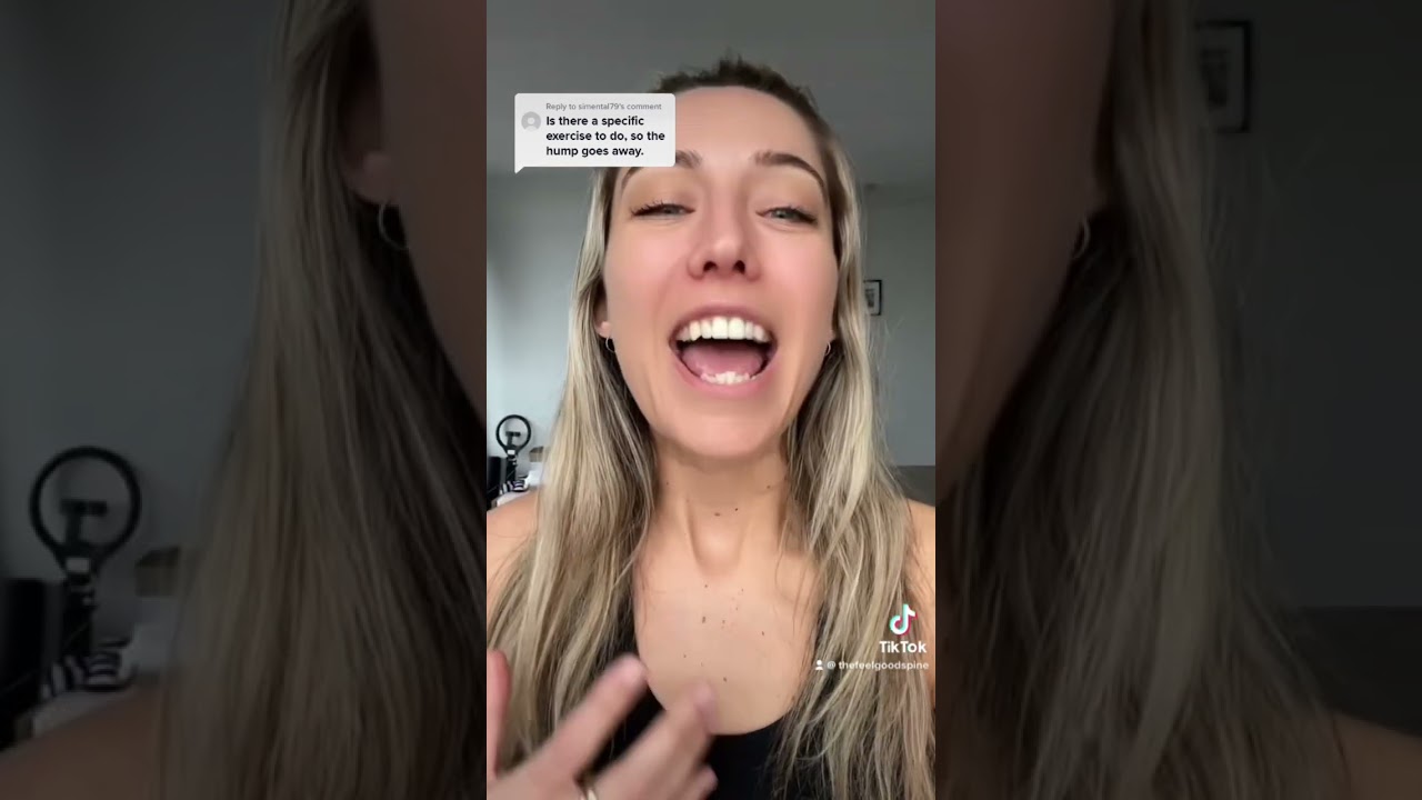 Exercises to help the scoliosis rib hump?