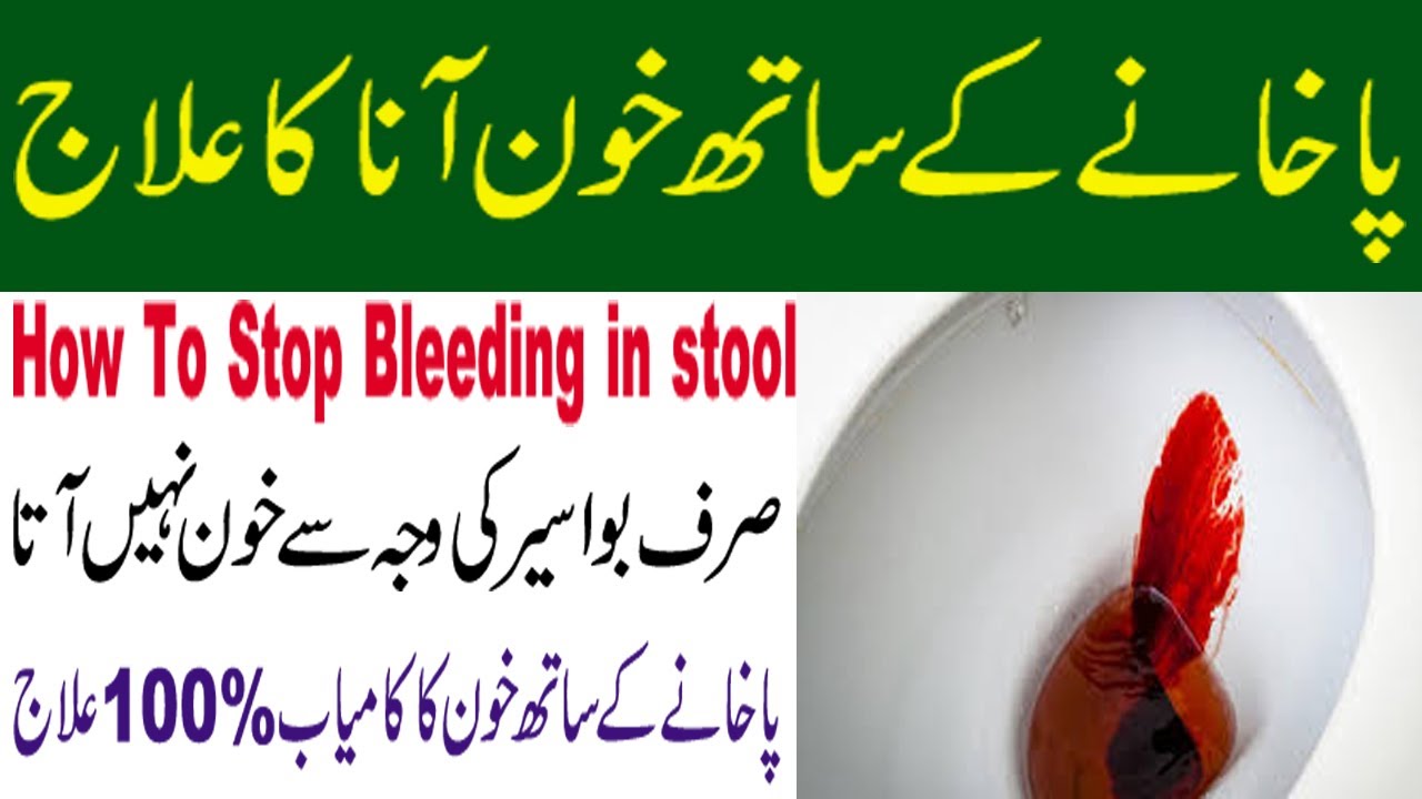 How To Stop Bleeding Stool Bleeding ka ilaj Pakhane k sath khoon Ana Ka