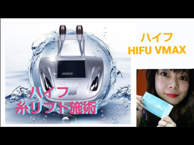 ハイフ HIFU VMAX 糸リフト施術 機種タイプは数値を確認して下さい 